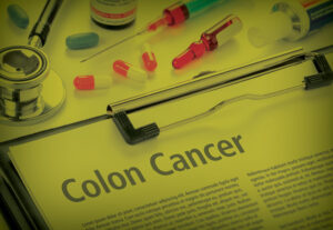 colorectal cancer